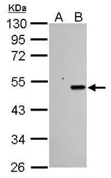 Anti-p53 antibody used in Western Blot (WB). GTX102965